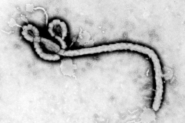 O mundo vive hoje a pior epidemia de ebola da história (Foto: Divulgação)